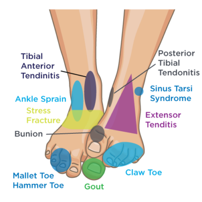 Diagnosing the causes of foot and ankle pain-totobed.com.vn