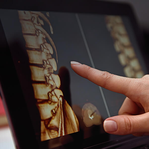Pointing to spine image on iPad
